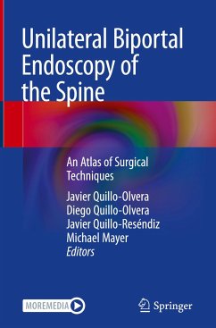 Unilateral Biportal Endoscopy of the Spine