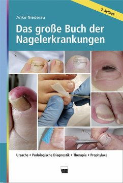 Das große Buch der Nagelerkrankungen - Niederau, Anke
