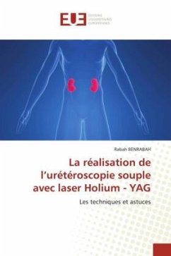 La réalisation de l¿urétéroscopie souple avec laser Holium - YAG - Benrabah, Rabah