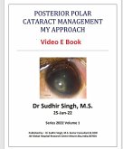Posterior Polar Cataract Management: My Approach (2022, #1) (eBook, ePUB) Posterior Polar Cataract Management: My Approach (2022, #1) (eBook, ePUB)