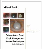 Cataract And Small Pupil Management Manual Techniques (2022, #1) (eBook, ePUB)