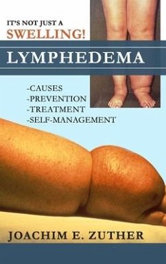 It's Not Just a Swelling! Lymphedema - Zuther, Joachim