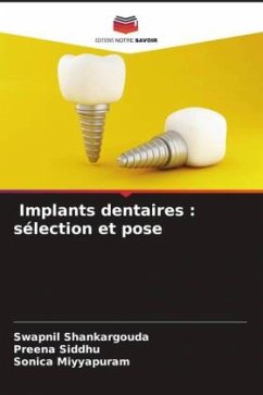 Implants dentaires : sélection et pose - Shankargouda, Swapnil;Siddhu, Preena;Miyyapuram, Sonica