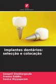 Implantes dentários: selecção e colocação