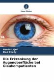 Die Erkrankung der Augenoberfläche bei Glaukompatienten