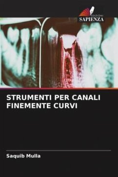 STRUMENTI PER CANALI FINEMENTE CURVI - Mulla, Saquib