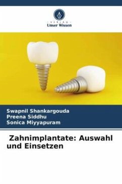 Zahnimplantate: Auswahl und Einsetzen - Shankargouda, Swapnil;Siddhu, Preena;Miyyapuram, Sonica