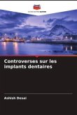 Controverses sur les implants dentaires