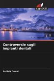 Controversie sugli impianti dentali