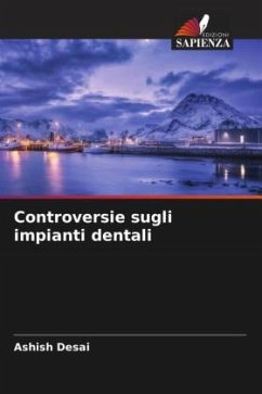 Controversie sugli impianti dentali - Desai, Ashish