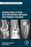 Interactions of Bone with Orthopedic Implants and Possible Failures (eBook, ePUB)