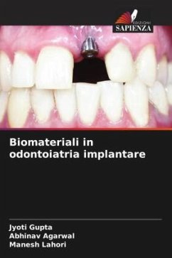Biomateriali in odontoiatria implantare - Gupta, Jyoti;Agarwal, Abhinav;Lahori, Manesh