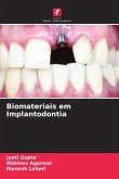 Biomateriais em Implantodontia