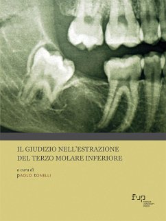 Il giudizio nell’estrazione del terzo molare inferiore (eBook, PDF) - Tonelli, Paolo