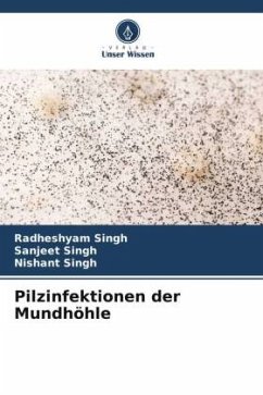 Pilzinfektionen der Mundhöhle - Singh, Radheshyam;Singh, Sanjeet;Singh, Nishant
