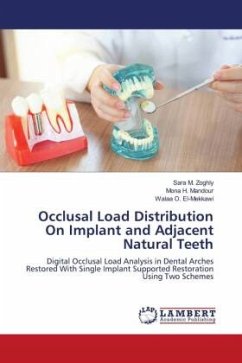 Occlusal Load Distribution On Implant and Adjacent Natural Teeth