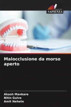 Malocclusione da morso aperto - Mankare, Akash;Gulve, Nitin;Nehete, Amit