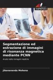 Segmentazione ed estrazione di immagini di risonanza magnetica mediante PCNN