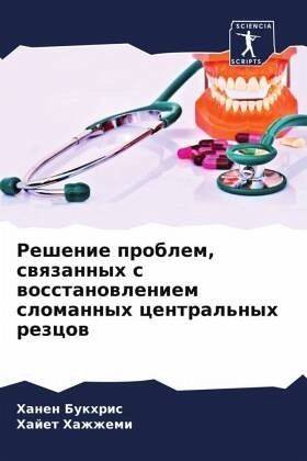 Reshenie problem, swqzannyh s wosstanowleniem slomannyh central'nyh rezcow Reshenie problem, swqzannyh s wosstanowleniem slomannyh central'nyh rezcow