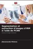 Segmentation et extraction d'images d'IRM à l'aide de PCNN