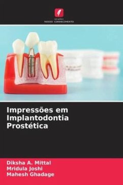 Impressões em Implantodontia Prostética - A. Mittal, Diksha;Joshi, Mridula;Ghadage, Mahesh