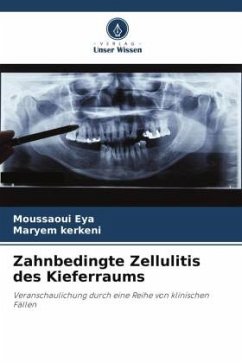 Zahnbedingte Zellulitis des Kieferraums - Eya, Moussaoui;kerkeni, Maryem