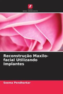 Reconstrução Maxilo-facial Utilizando Implantes - Pendharkar, Seema