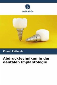 Abdrucktechniken in der dentalen Implantologie - Pathania, Komal