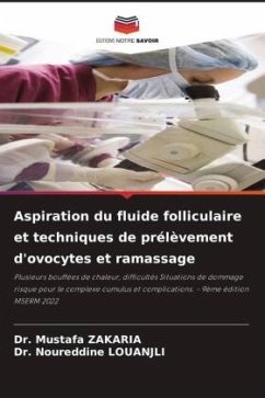 Aspiration du fluide folliculaire et techniques de prélèvement d'ovocytes et ramassage - Zakaria, Dr. Mustafa;LOUANJLI, Dr. Noureddine