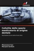 Cellulite dello spazio masticatorio di origine dentale