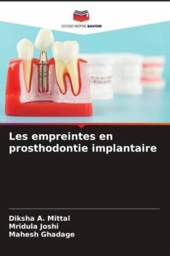 Les empreintes en prosthodontie implantaire - A. Mittal, Diksha;Joshi, Mridula;Ghadage, Mahesh