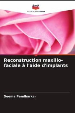 Reconstruction maxillo-faciale à l'aide d'implants - Pendharkar, Seema