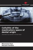 Cellulitis of the masticatory space of dental origin
