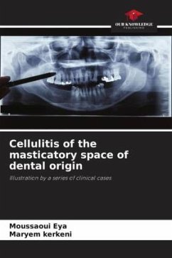 Cellulitis of the masticatory space of dental origin - Eya, Moussaoui;kerkeni, Maryem