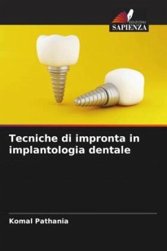 Tecniche di impronta in implantologia dentale - Pathania, Komal