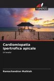 Cardiomiopatia ipertrofica apicale