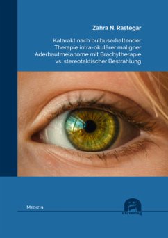 Katarakt nach bulbuserhaltender Therapie intra-okulärer maligner Aderhautmelanome mit Brachytherapie vs. stereotaktische - Rastegar, Zahra N.