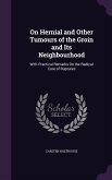 On Hernial and Other Tumours of the Groin and Its Neighbourhood