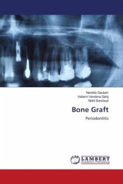 Bone Graft - Gautam, Nandita;Garg, Vaitarni Vandana;Bansiwal, Nidhi