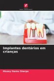 Implantes dentários em crianças