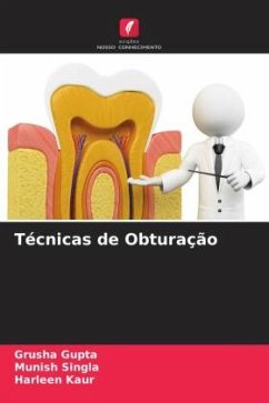 Técnicas de Obturação - Gupta, Grusha;Singla, Munish;Kaur, Harleen