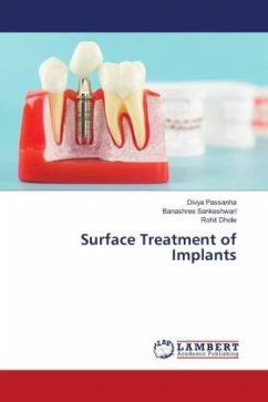 Surface Treatment of Implants - Passanha, Divya;Sankeshwari, Banashree;Dhole, Rohit