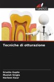 Tecniche di otturazione