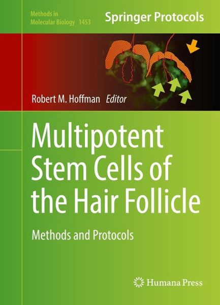 Multipotent Stem Cells of the Hair Follicle (eBook, PDF) Multipotent Stem Cells of the Hair Follicle (eBook, PDF)