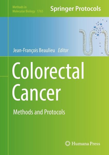Colorectal Cancer (eBook, PDF) Colorectal Cancer (eBook, PDF)