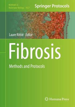 Cover Fibrosis (eBook, PDF)
