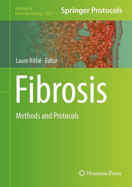 Fibrosis (eBook, PDF)