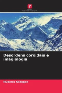 Desordens coroidais e imagiologia - Akdogan, Muberra