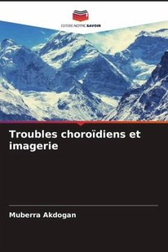 Troubles choroïdiens et imagerie - Akdogan, Muberra