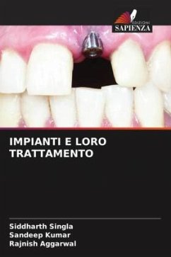 IMPIANTI E LORO TRATTAMENTO - Singla, Siddharth;Kumar, Sandeep;AGGARWAL, RAJNISH